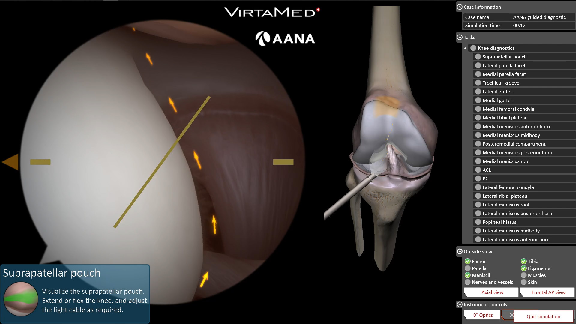 ArthroS arthroscopy view
